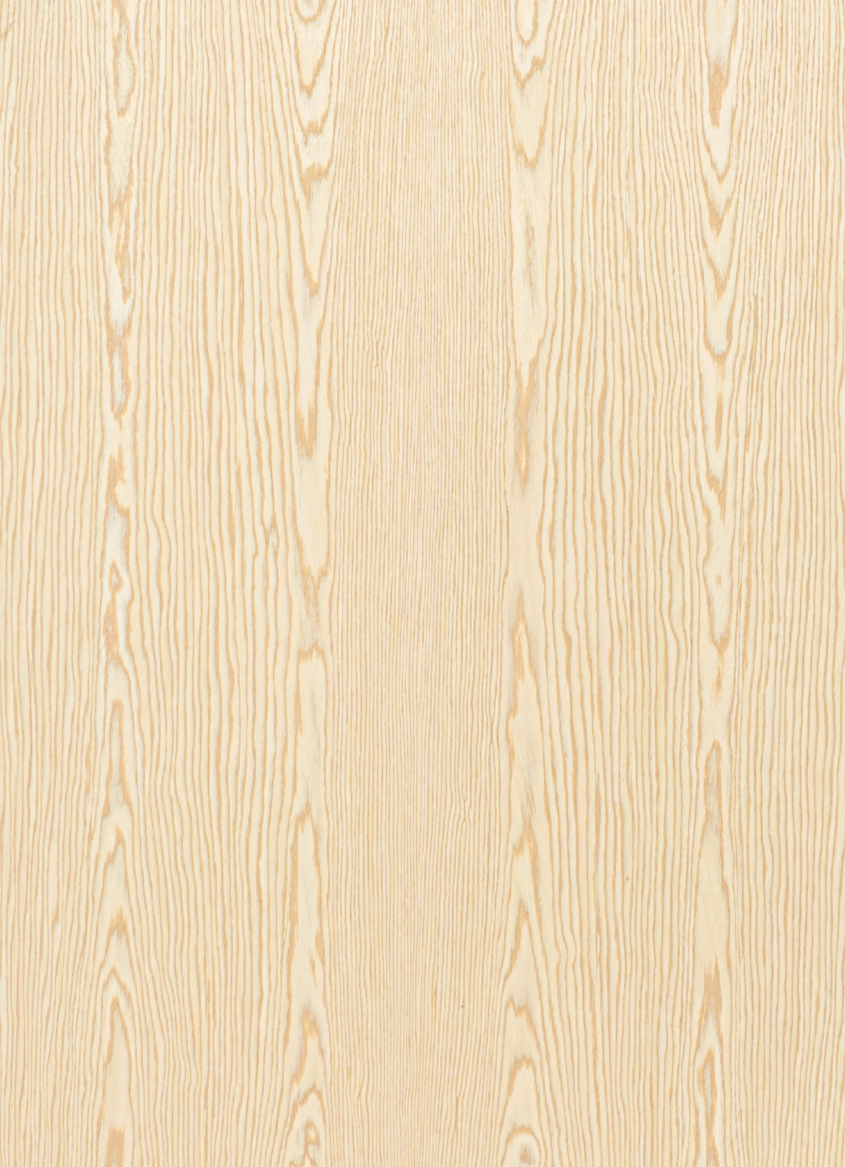 veneers